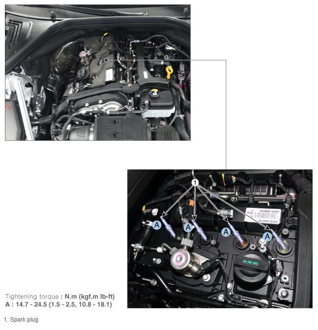 G14753025